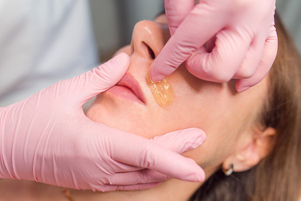 Épilation visage - Forfait 3 zones - 20 min.